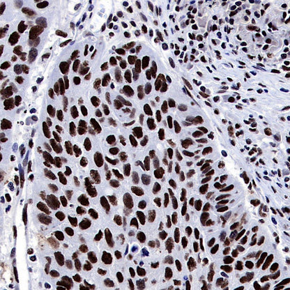 ARID1A Recombinant Rabbit mAb (S-440-62)