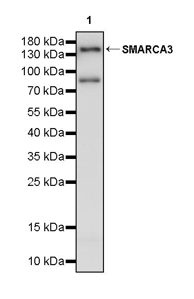 SMARCA3 Recombinant Rabbit mAb (S-3575-154)