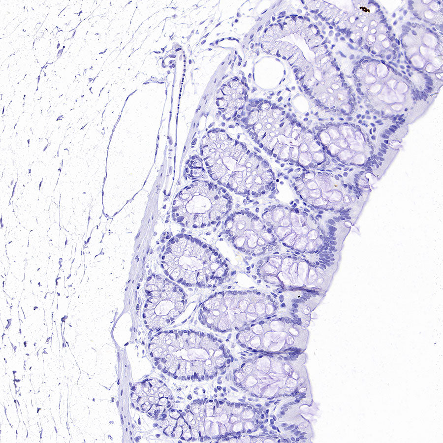 ALPI Recombinant Rabbit mAb (S-3768-104)