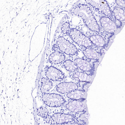 ALPI Recombinant Rabbit mAb (S-3768-104)