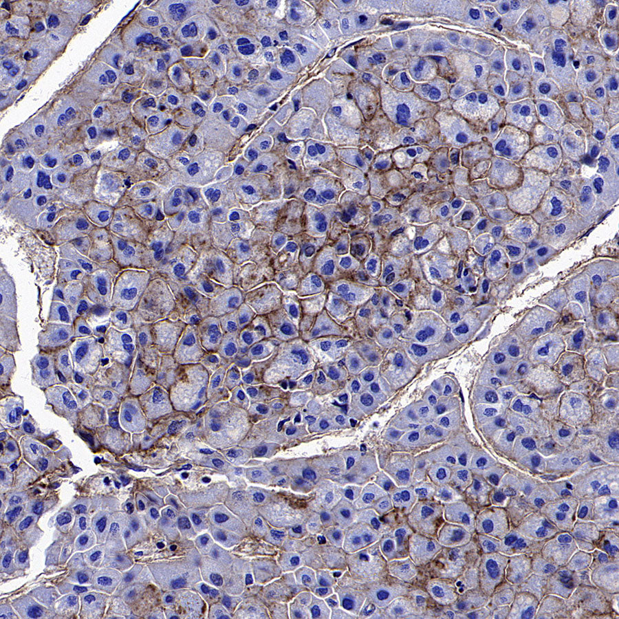 CD151 Recombinant Rabbit mAb (S-3235-104)