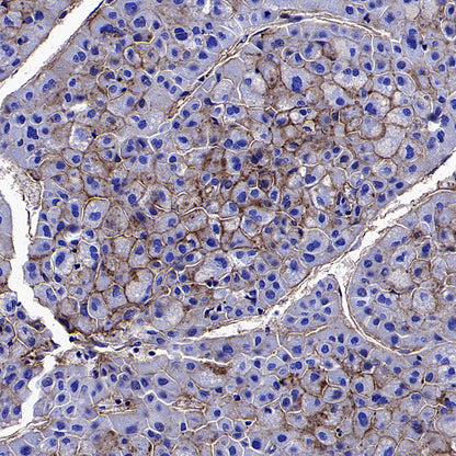 CD151 Recombinant Rabbit mAb (S-3235-104)