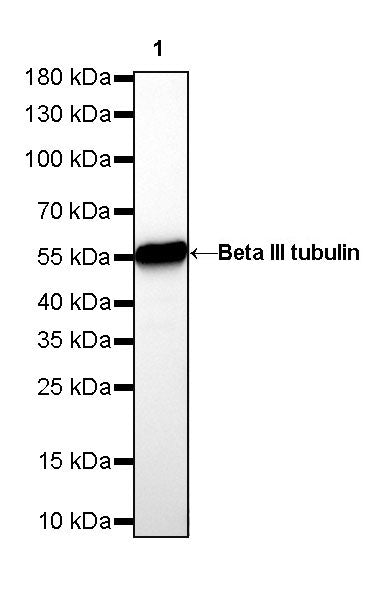 Beta III tubulin Recombinant Rabbit mAb (SDT-251-28)
