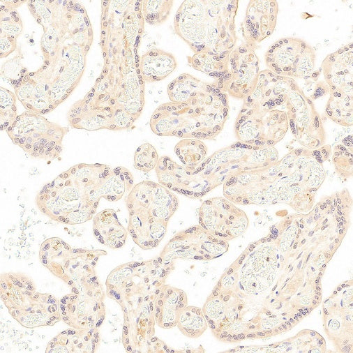 SOCS2 Recombinant Rabbit mAb (S-4956-21)