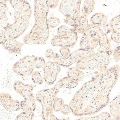 SOCS2 Recombinant Rabbit mAb (S-4956-21)