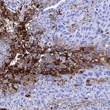 uPAR/CD87 Recombinant Rabbit mAb (S-3960-82)
