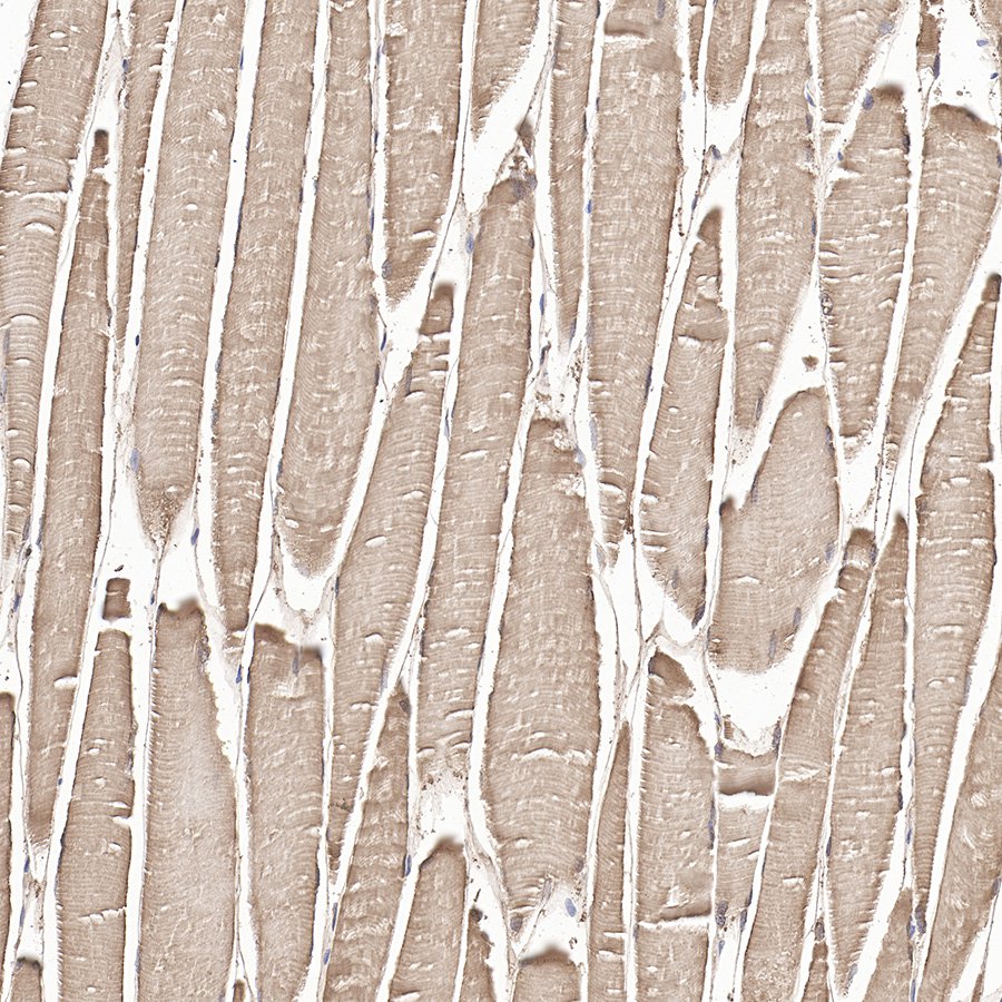 Myoglobin Recombinant Rabbit mAb (SDT-097-10)