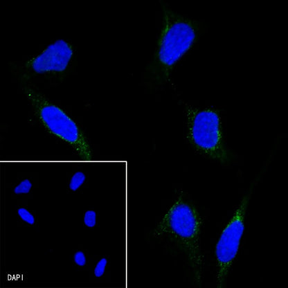 PI3 Kinase p85 Recombinant Rabbit mAb (SDT-R108)