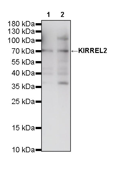 KIRREL2 Recombinant Rabbit mAb (S-4624-78)