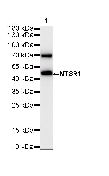 NTSR1 Recombinant Rabbit mAb (S-4844-38)