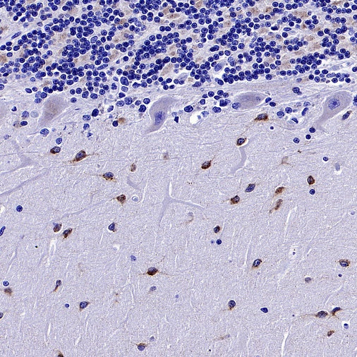 SEZ6 Recombinant Rabbit mAb (SDT-2097-737)