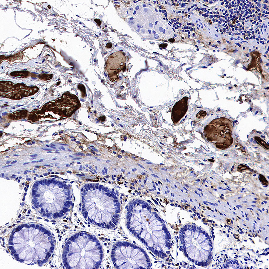 Apolipoprotein CIII Recombinant Rabbit mAb (S-5408)