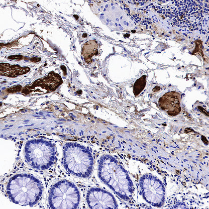 Apolipoprotein CIII Recombinant Rabbit mAb (S-5408)