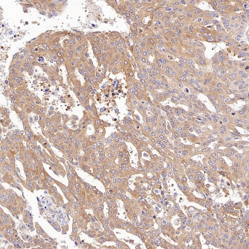 NF-κB2 p100/p52 Recombinant Rabbit mAb (S-2502-208)