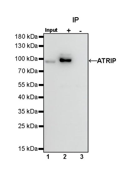 ATRIP Recombinant Rabbit mAb (S-1275-48)