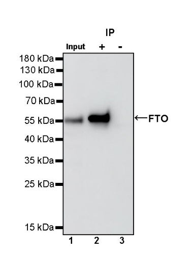 FTO Recombinant Rabbit mAb (S-1663-48)