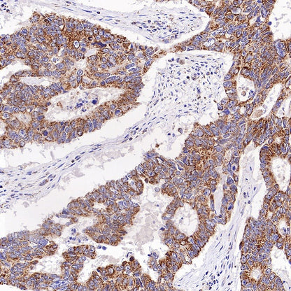 UQCRC2 Recombinant Rabbit mAb (S-2374-127)