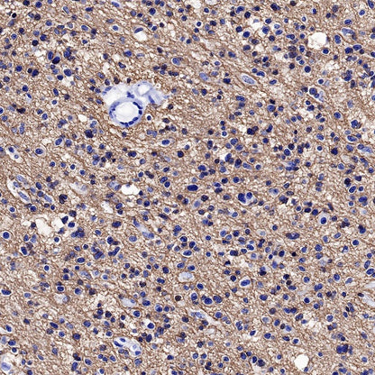 CD56 Recombinant Rabbit mAb (SDT-5000)
