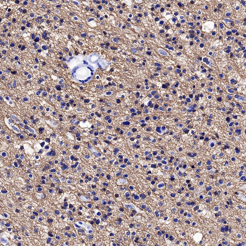 CD56 Recombinant Rabbit mAb (SDT-5000)