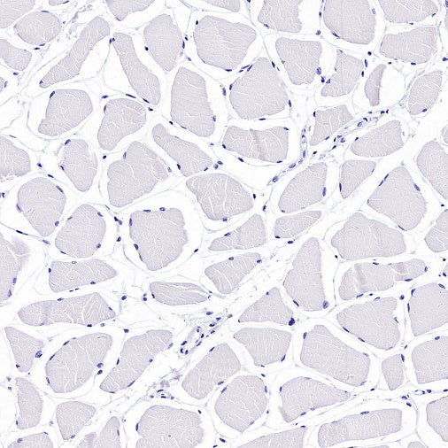 CD112/Nectin-2 Recombinant Rabbit mAb (S-2404-66)