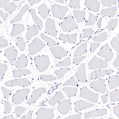 CD112/Nectin-2 Recombinant Rabbit mAb (S-2404-66)