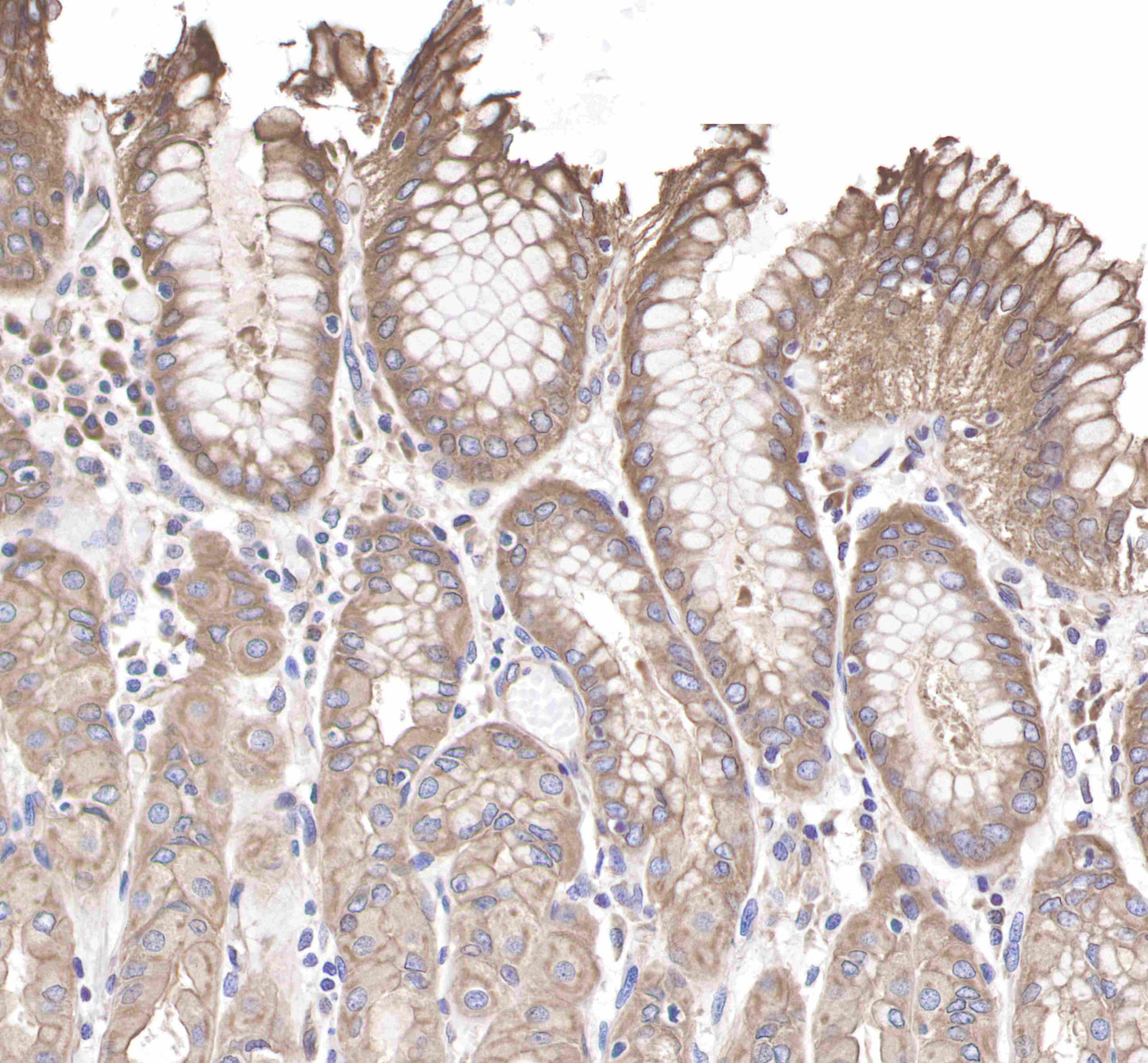 c-Met Rabbit mAb(SDT-009-7-2)