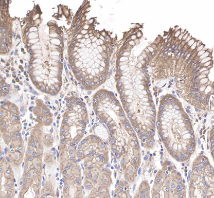 c-Met Rabbit mAb(SDT-009-7-2)