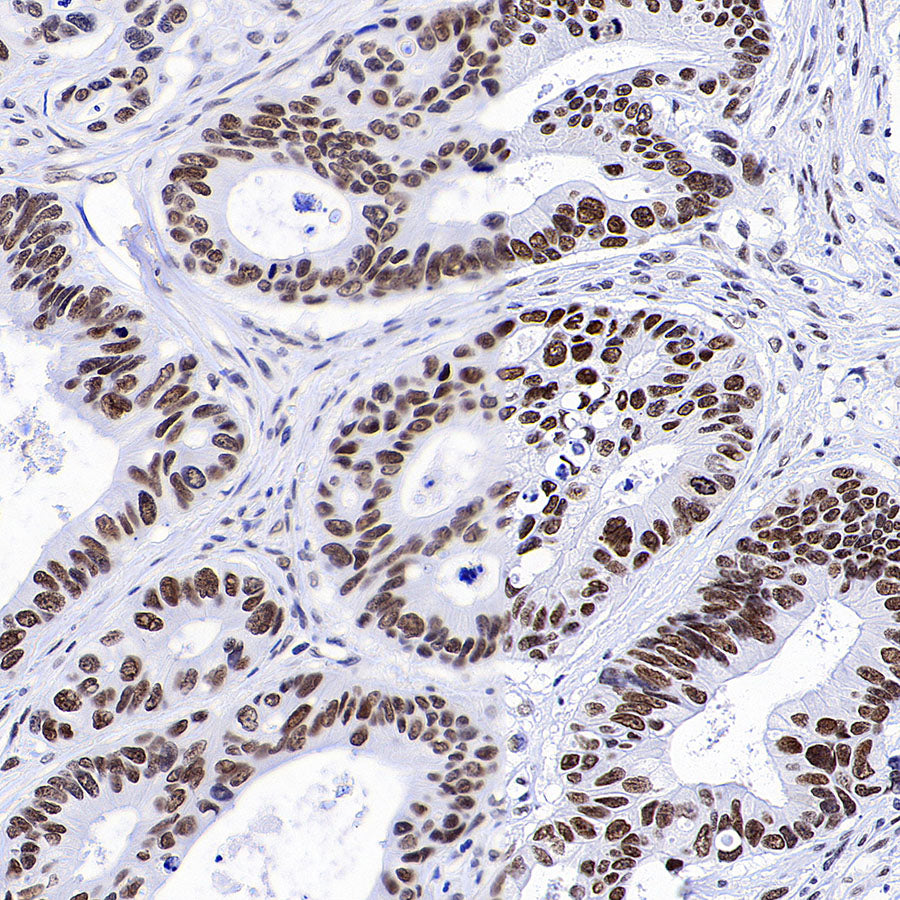 Bmi1 Recombinant Rabbit mAb (S-5143)
