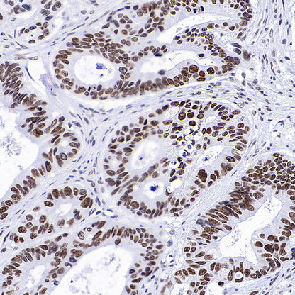 Bmi1 Recombinant Rabbit mAb (S-5143)