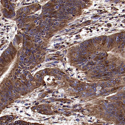 IFITM3 Rabbit Polyclonal Antibody
