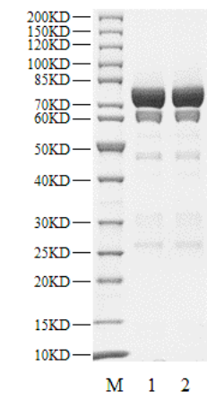 MAPKAPK5 GST Tag Protein, Human