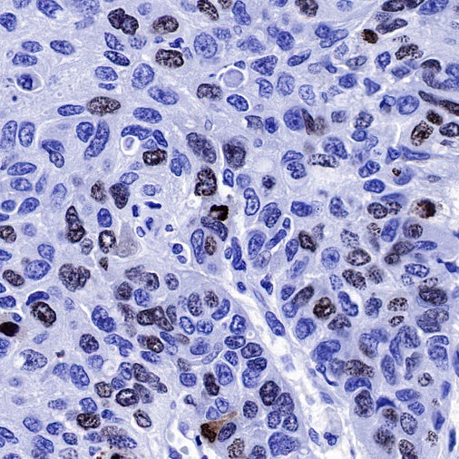 S-RMab® Ki67 Recombinant Rabbit mAb (SDT-R459)