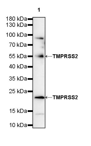 TMPRSS2 Recombinant Rabbit mAb (S-735-40)