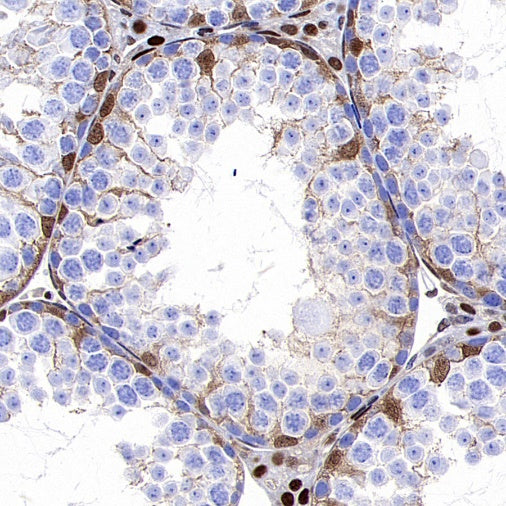 p27 Kip1 Recombinant Rabbit mAb (SDT-361-324)