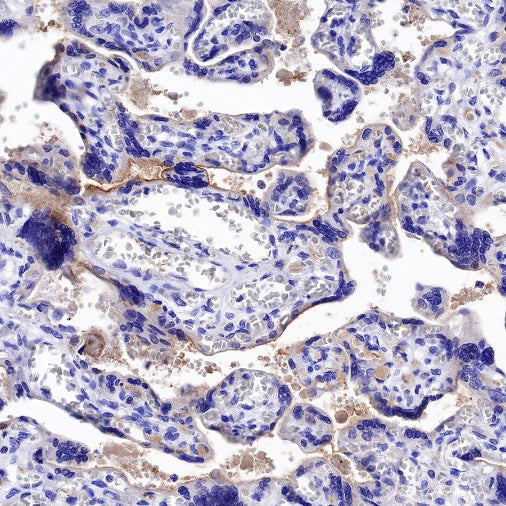 Nectin-4 Recombinant Rabbit mAb (SDT-277-326)