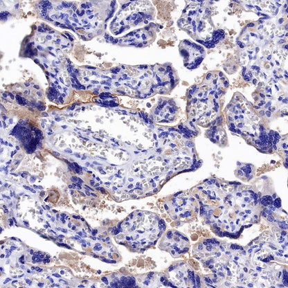 Nectin-4 Recombinant Rabbit mAb (SDT-277-326)