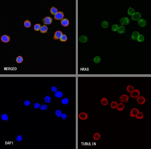 H-Ras Recombinant Rabbit mAb (S-1017-79)