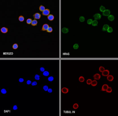 H-Ras Recombinant Rabbit mAb (S-1017-79)