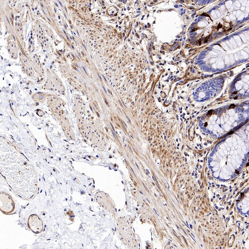Vinculin Recombinant Rabbit mAb (S-1635-3)