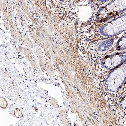 Vinculin Recombinant Rabbit mAb (S-1635-3)