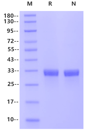 Angiopoietin-2(275-496) His Tag Protein, Human