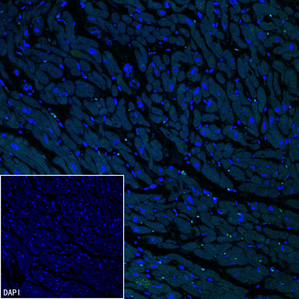 AK1C3 Rabbit Polyclonal Antibody