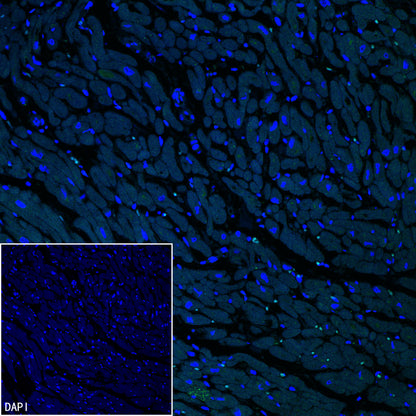 AK1C3 Rabbit Polyclonal Antibody