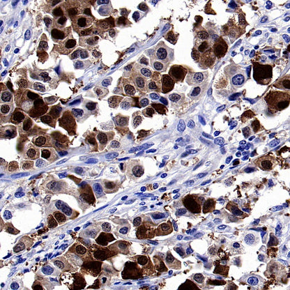 DARPP32 Recombinant Rabbit mAb (S-1637-62)