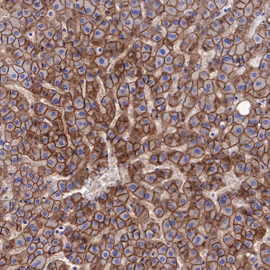 N-Cadherin Recombinant Rabbit mAb (SDT-329-12)