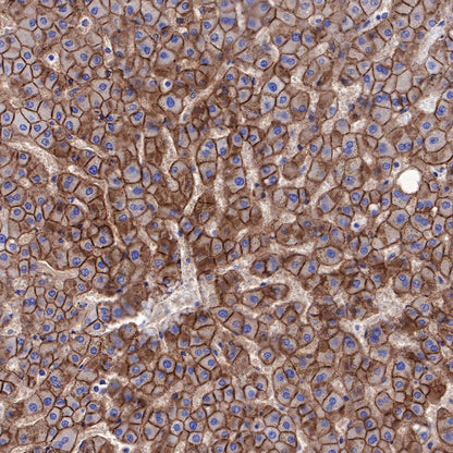 N-Cadherin Recombinant Rabbit mAb (SDT-329-12)