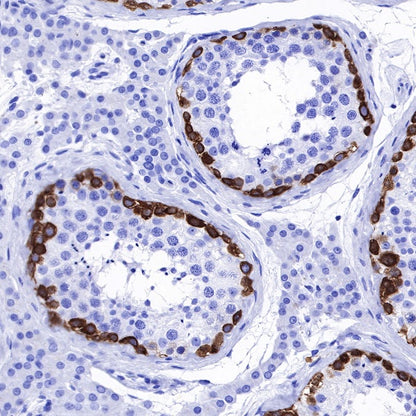 MAGE-A1 Recombinant Rabbit mAb (S-R183)