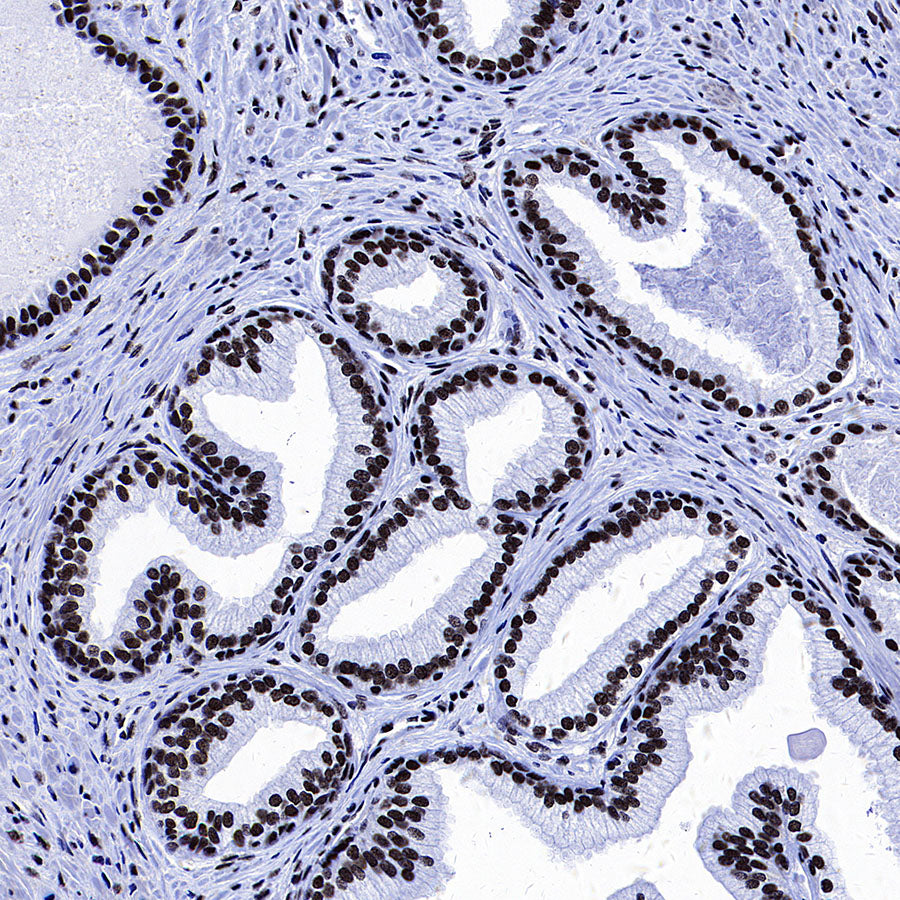 p300 Recombinant Rabbit mAb (S-2612-122)