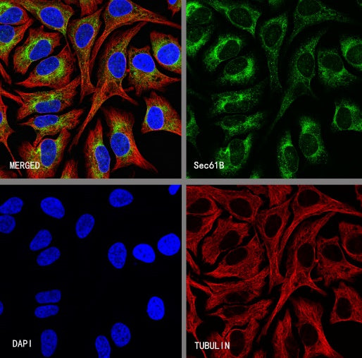Sec61B Recombinant Rabbit mAb (S-4499-3)