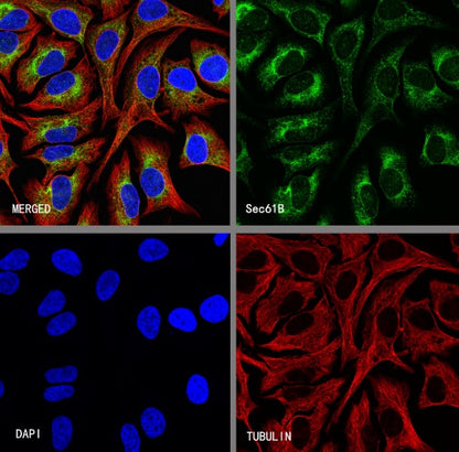 Sec61B Recombinant Rabbit mAb (S-4499-3)